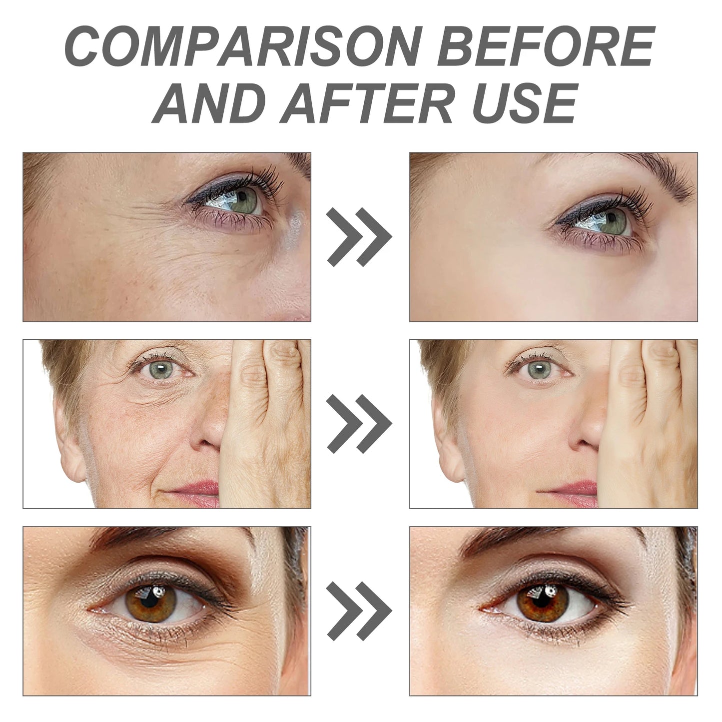 Serum anti rides SEOUL 1988