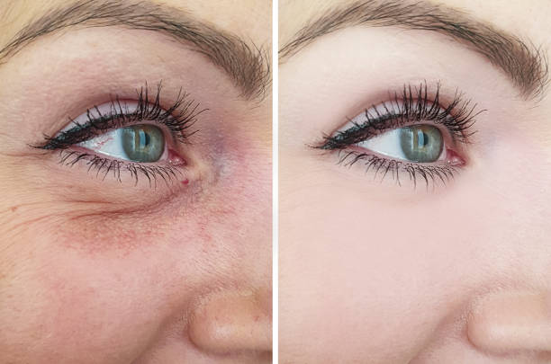 Retinol Vitamin E Set – Lift, Glow & Anti-Aging